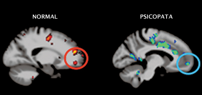 psicologiasdobrasil.com.br - Circuito cerebral da maldade