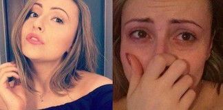 Mulher mostra selfies do antes e depois de uma crise de pânico