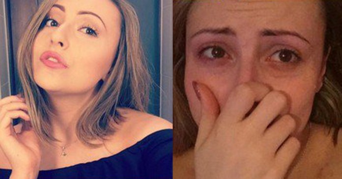 Mulher mostra selfies do antes e depois de uma crise de pânico