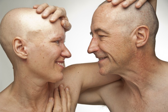 Recente pesquisa revela: pessoas com câncer que são casadas podem viver mais