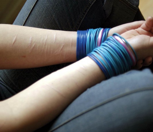 Automutilação/Cutting: Ferir o corpo para aquietar a mente.