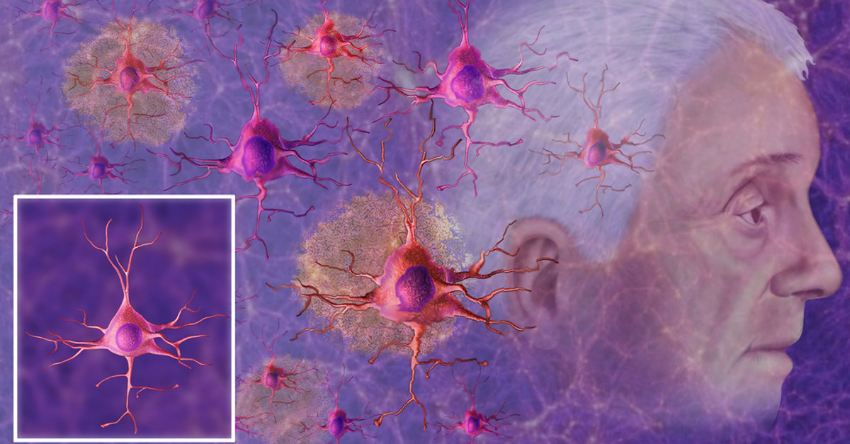 o-que-acontece-no-meu-cerebro-quando-tenho-alzheimer