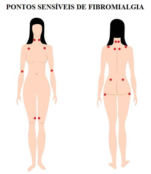 psicologiasdobrasil.com.br - Você conhece os sintomas da fibromialgia?