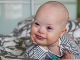 Islândia praticamente erradicou a Síndrome de Down, mas de uma forma bem polêmica