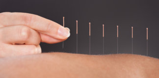 Acupuntura diminui a ansiedade?