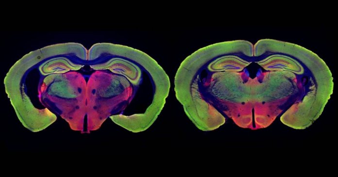 Tratamento com luzes pode retardar (e talvez reverter) os sintomas do Alzheimer