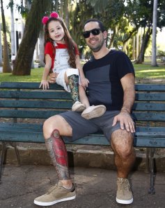 psicologiasdobrasil.com.br - Pai tatua prótese na perna para ficar igual à filha: “Somos todos iguais”