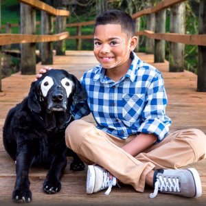 psicologiasdobrasil.com.br - Menino com vitiligo recupera autoestima ao conhecer cão labrador com a mesma condição