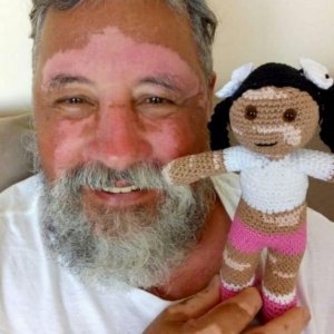 psicologiasdobrasil.com.br - Vovô cria bonecas de crochê com vitiligo para promover inclusão