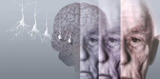Depressão pode afetar o cérebro tanto quanto o Alzheimer