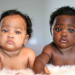 psicologiasdobrasil.com.br - Gêmeas com tons de pele diferentes são o mais fofo retrato da diversidade