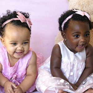 psicologiasdobrasil.com.br - Gêmeas com tons de pele diferentes são o mais fofo retrato da diversidade