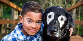 Menino com vitiligo recupera autoestima ao conhecer cão labrador com a mesma condição