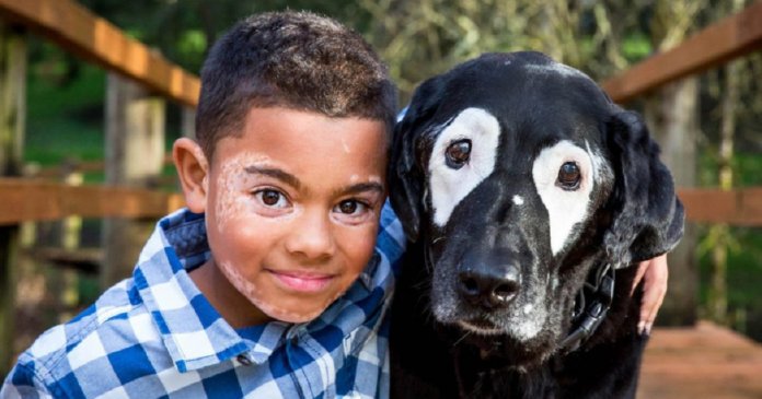Menino com vitiligo recupera autoestima ao conhecer cão labrador com a mesma condição