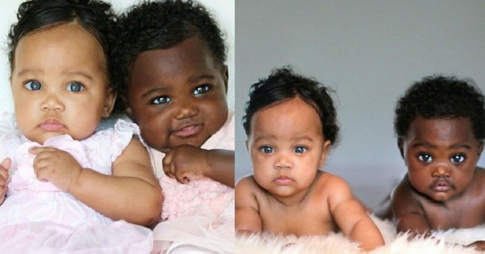 Gêmeas com tons de pele diferentes são o mais fofo retrato da diversidade