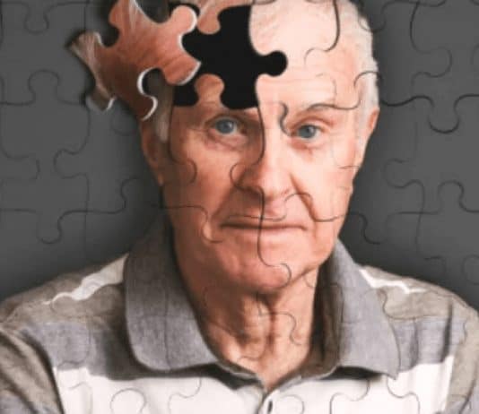 Pessoas que carregam esta característica genética podem desenvolver demência mais cedo