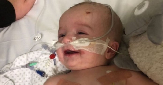 Após sete meses em coma, bebê acorda e sorri para o pai