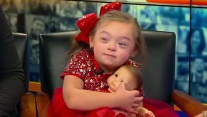 psicologiasdobrasil.com.br - Menina com síndrome de Down se torna modelo em campanha de Natal