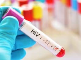 Caminho para a cura: pesquisadores descobrem como eliminar HIV do corpo