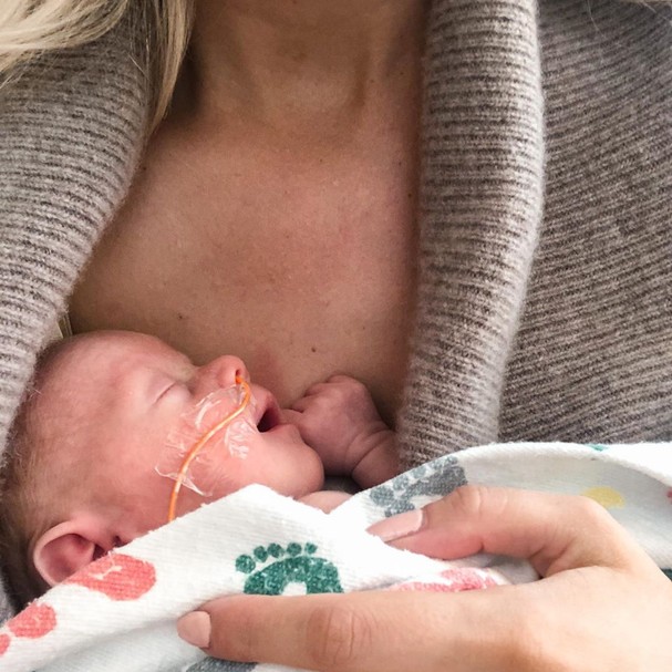 psicologiasdobrasil.com.br - Mãe que deu à luz em coma por coronavírus abraça filha pela primeira vez