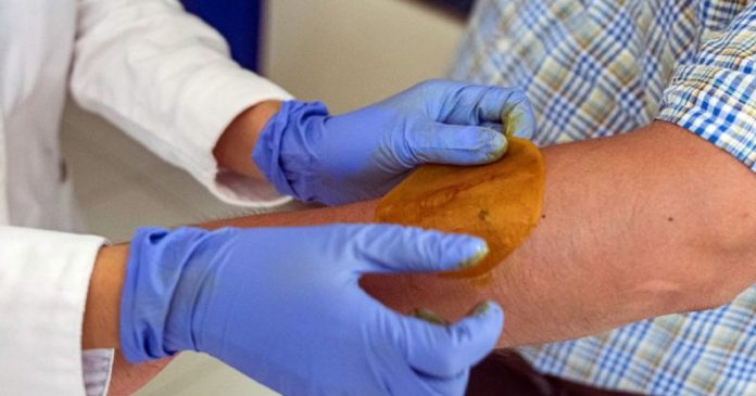 Pesquisadores criam adesivo capaz de regenerar pele de pessoas com diabetes em 21 dias