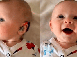 Bebezinha surda tem a reação mais linda ao ouvir pela primeira vez com aparelho