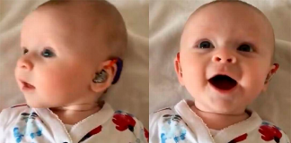 Bebezinha surda tem a reação mais linda ao ouvir pela primeira vez com aparelho