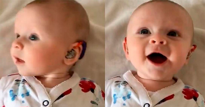 Bebezinha surda tem a reação mais linda ao ouvir pela primeira vez com aparelho