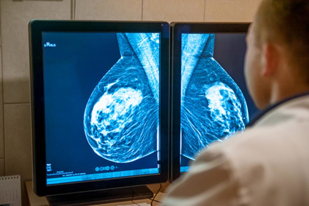 psicologiasdobrasil.com.br - Inteligência artificial jé é capaz de prever câncer de mama cinco anos antes de apresentar sintomas