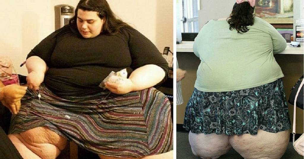 psicologiasdobrasil.com.br - A incrível história de superação da jovem que já pesou 298 kg