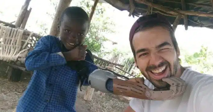 1-Engenheiro-usa-impressora-3D-para-criar-próteses-gratuitas-para-pessoas-carentes Engenheiro usa impressora 3D para criar próteses gratuitas para pessoas carentes