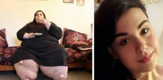 A incrível história de superação da jovem que já pesou 298 kg