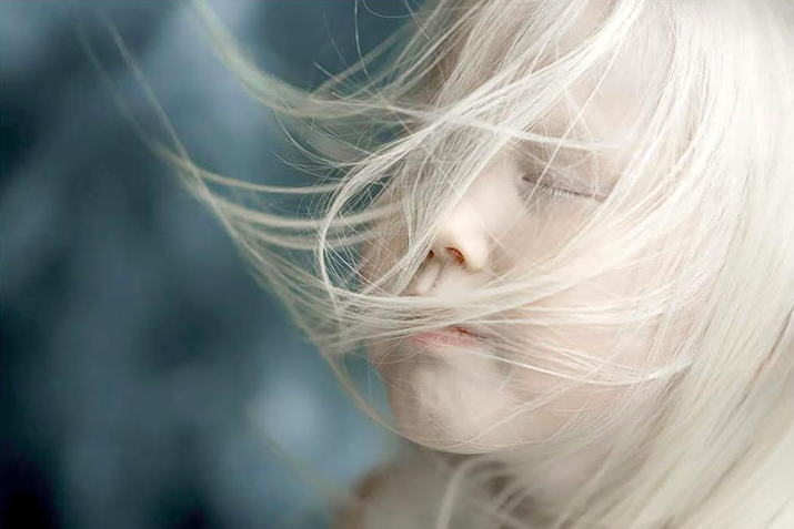 psicologiasdobrasil.com.br - Menina albina de 8 anos choca o mundo com sua beleza única