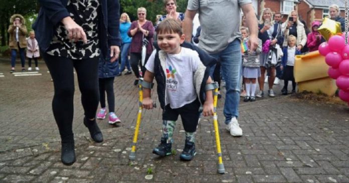 Garotinho que perdeu as pernas arrecada 1 milhão de dólares para hospital que salvou sua vida