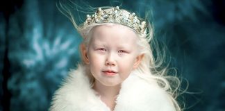 Menina albina de 8 anos choca o mundo com sua beleza única