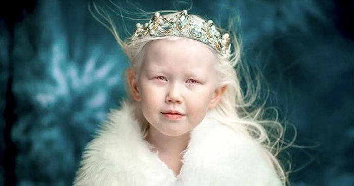 Menina albina de 8 anos choca o mundo com sua beleza única