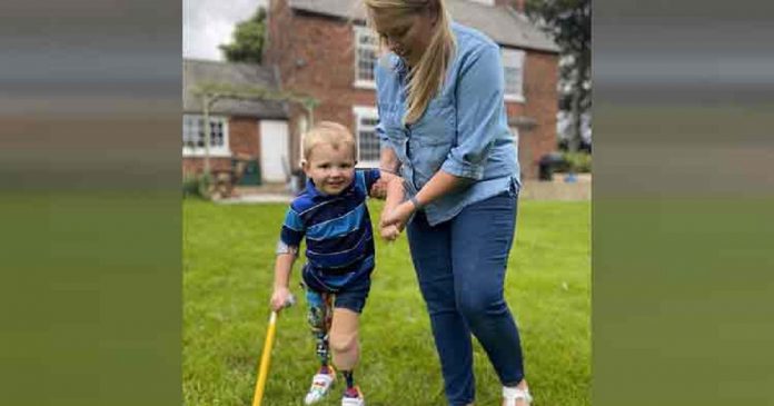 Menino de 4 anos que perdeu as duas pernas inspira o mundo ao dar os primeiros passos