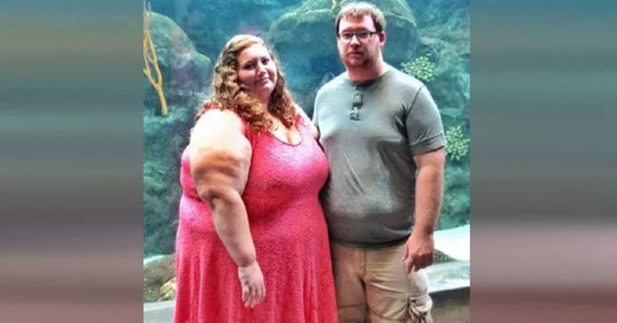 Casal com obesidade mórbida perdem juntos 139 quilos em um ano e ficam irreconhecíveis