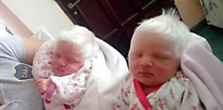 Essas gêmeas nasceram com lindos cabelos brancos