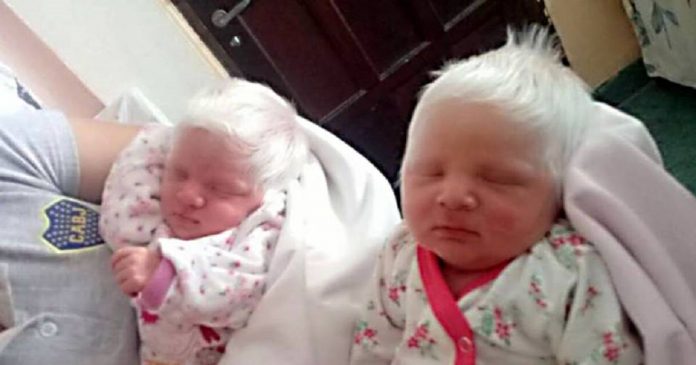 Essas gêmeas nasceram com lindos cabelos brancos