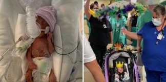 Valente bebê prematuro nascido com 22 semanas conseguiu sobreviver. Deixou o hospital como um rei