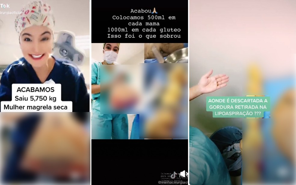 psicologiasdobrasil.com.br - Cirurgiã compartilha vídeos com pele e gordura de pacientes após cirurgia e é interditada