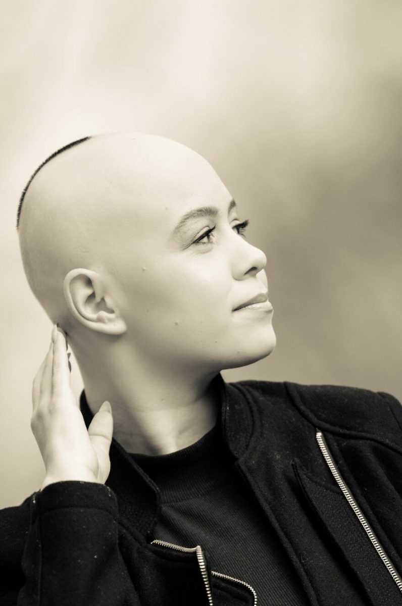 psicologiasdobrasil.com.br - Jornalista desiste de perucas, aceita sua alopecia e convida as pessoas a se amarem como são