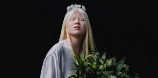 Chinesa albina que foi abandonada quando bebê se torna modelo da Vogue
