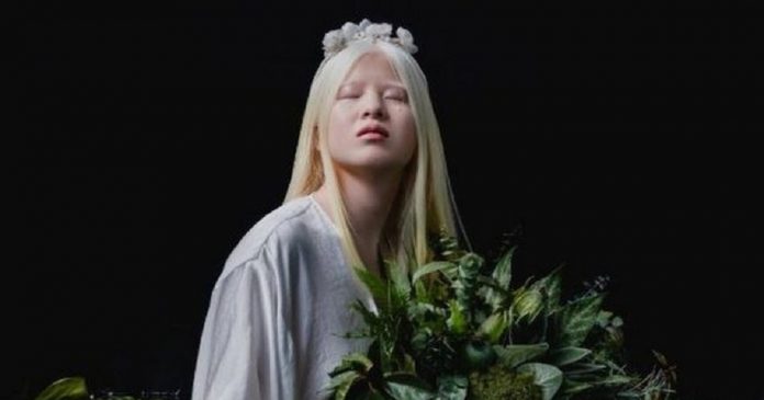 Chinesa albina que foi abandonada quando bebê se torna modelo da Vogue