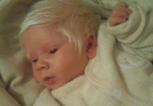 psicologiasdobrasil.com.br - Bebê nasce com os cabelos totalmente brancos e vira 'celebridade' na maternidade