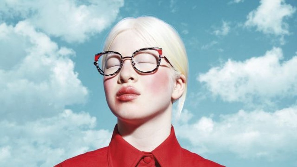 psicologiasdobrasil.com.br - Chinesa albina que foi abandonada quando bebê se torna modelo da Vogue