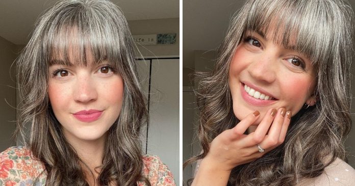 Jovem de 29 anos decide aceitar cabelos grisalhos depois de brigar com eles desde os 12