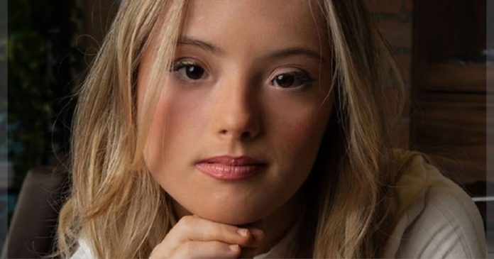 L’Oréal Paris anuncia jovem com Síndrome de Down como nova embaixadora da marca