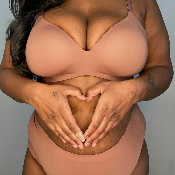 psicologiasdobrasil.com.br - Mulheres compartilham fotos sem edição para normalizar corpos reais